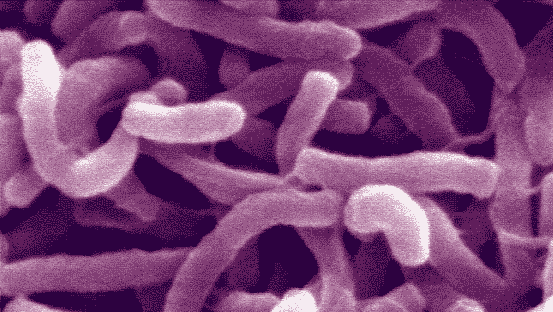 So sehen Cholera-Bakterien aus: Sie wirken harmlos, können aber töten.